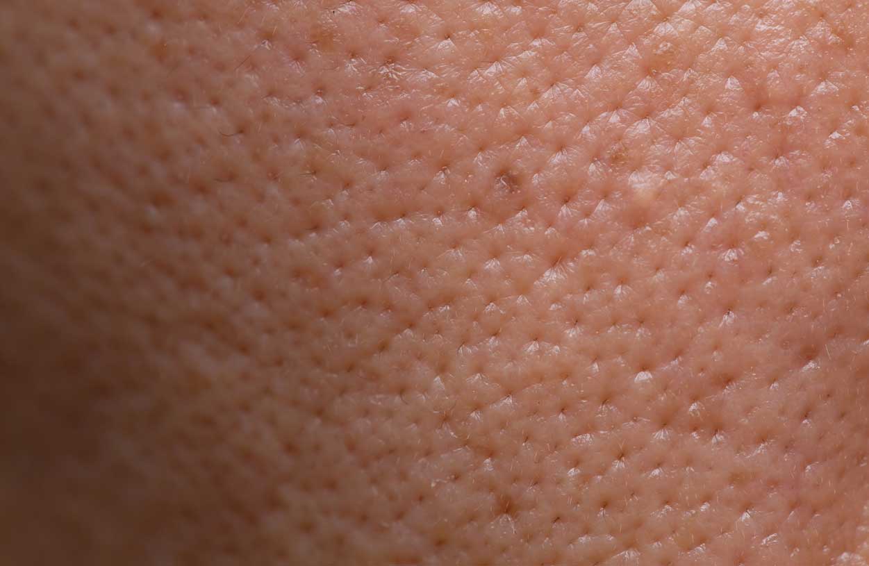 Vetenskaplig hudvårdsguide: Stora porer