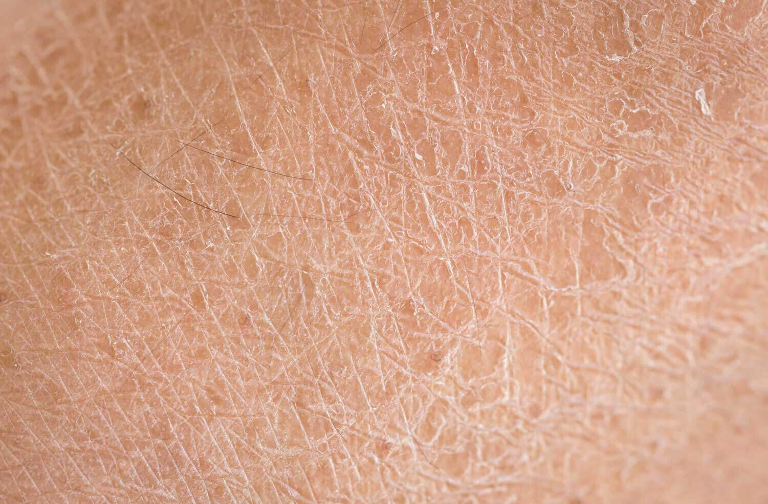 Vetenskaplig hudvårdsguide: Uttorkad och yttorr hud